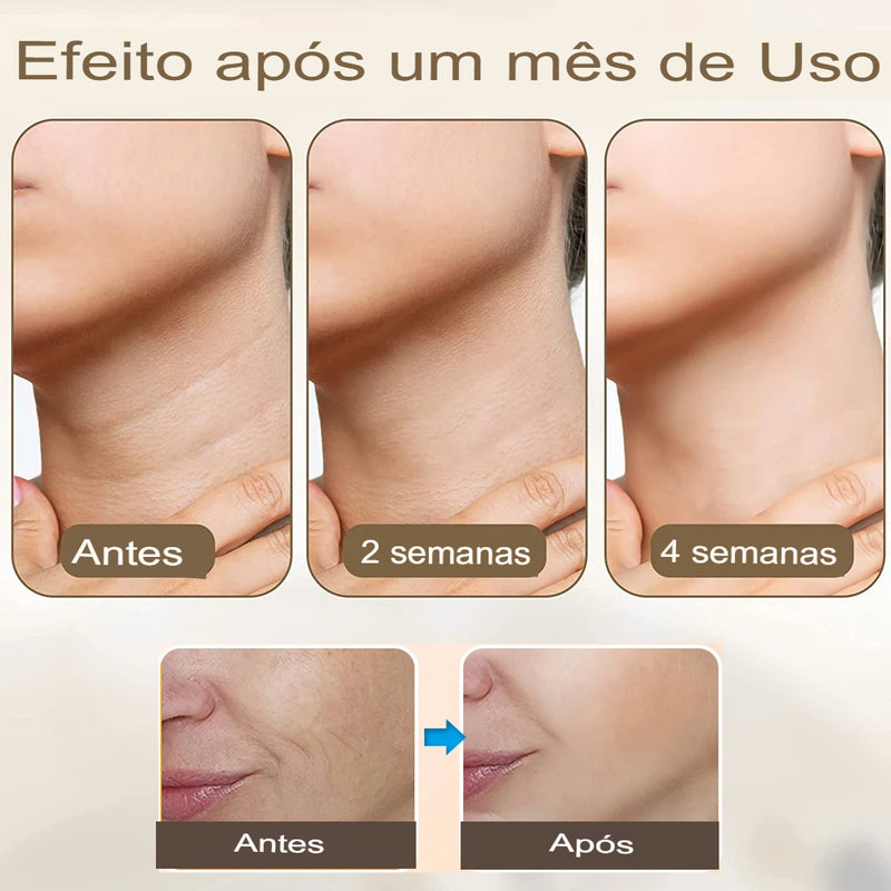 Massageador Facial Lifting